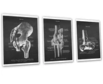 Anatomy Decor Set Of 3 Unframed Hip Knee Ankle Joints Prints New. Price: $62.00.